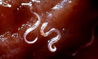 Parasites That Could be Infecting You Right Now