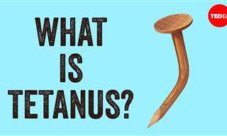 What You Need to Know About Tetanus