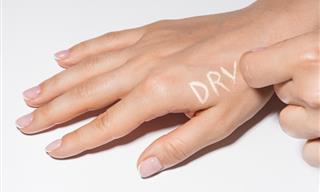 Dry Hands: Causes, Prevention and Treatment