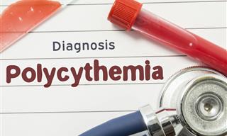 Understanding Polycythemia Vera
