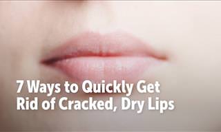 7 Ways to Quickly Get Rid of Cracked, Dry Lips