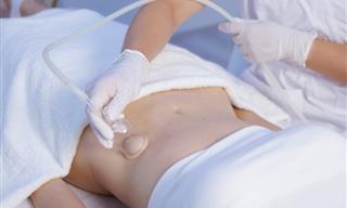 New Treatments for Ulcerative Colitis