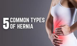Hernia - 5 Common Types and Symptoms