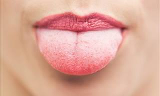10 Natural Remedies to Heal a Burnt Tongue