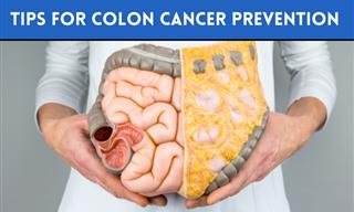 How to Prevent Colorectal Cancer – 8 Useful Tips