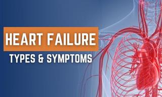 The 4 Types of Heart Failure - a Short Overview