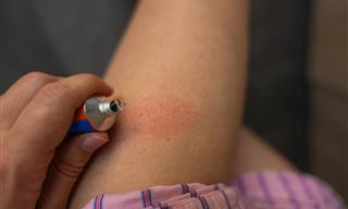 Five Natural Solutions for Bad Chafing