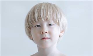 20 Stunning Portraits Showing Albinism's Beauty