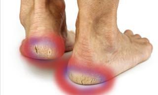 The Effects of Aging on Your Ankles & Feet