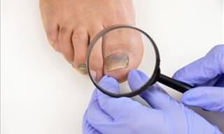 Diagnose Health Issues by Looking at Your Nails