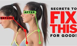 How to Fix Your Forward Head Posture