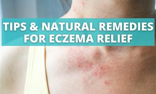 Relieve Skin Itching and Dryness With These Eczema Remedies
