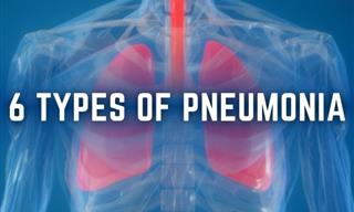 The 6 Common Types of Pneumonia Explained