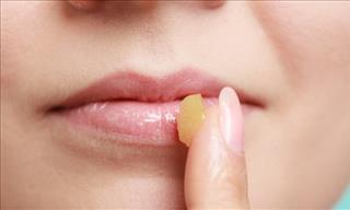 10 Tips to Heal Cracked and Dry Lips!