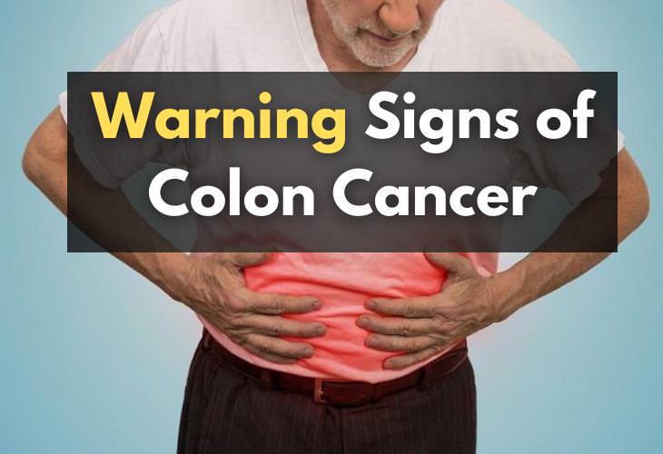 7 Colon Cancer Red Flags That Are Often Overlooked