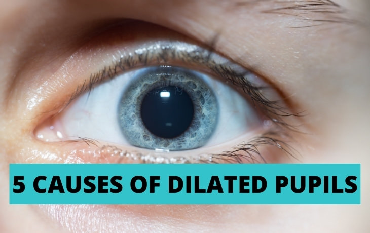 causes of fixed dilated pupil