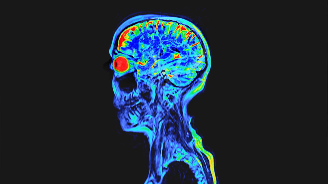 Elder brain. Амеба Пожиратель мозга. Мозг после неглерия Фоулера.