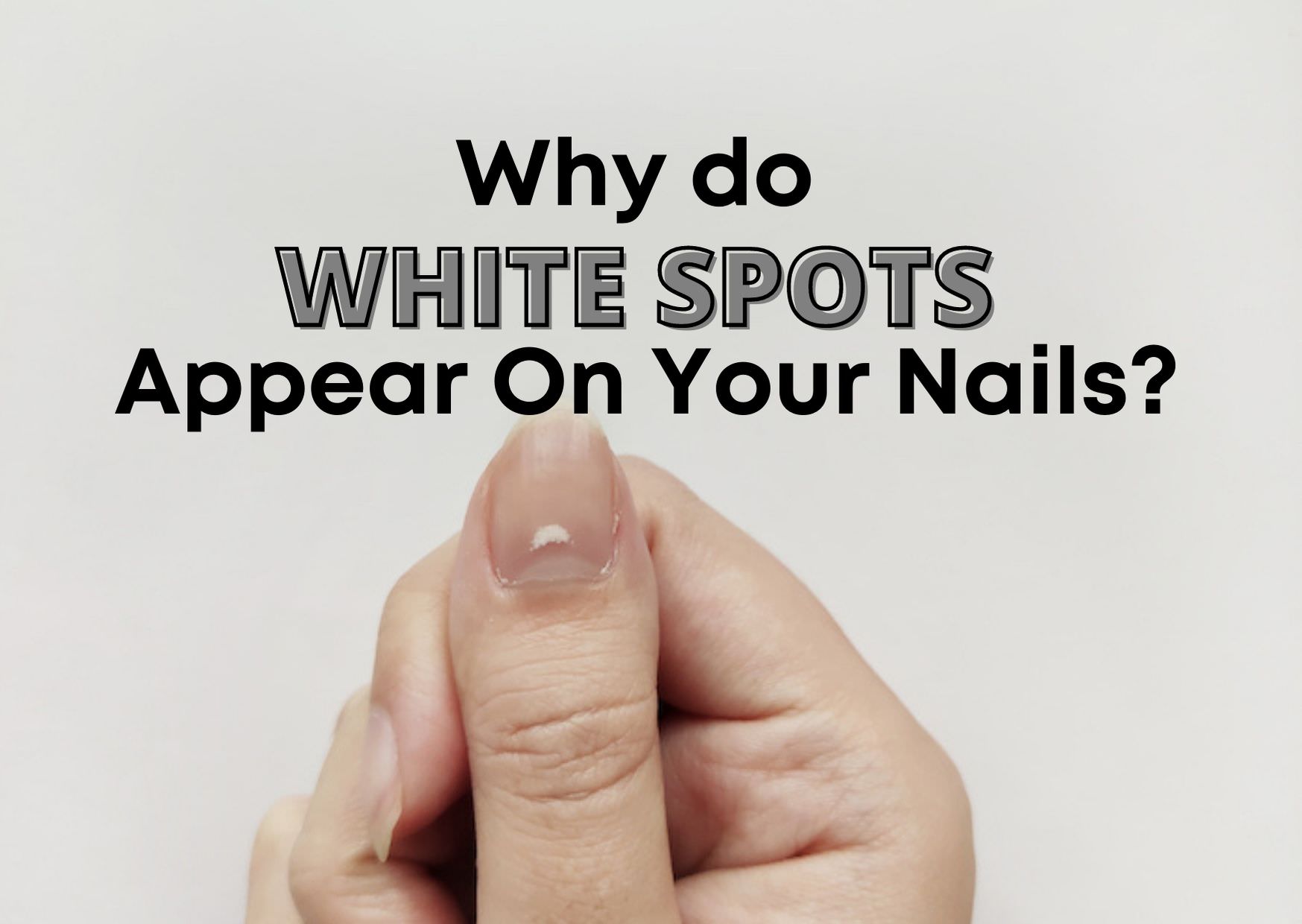 what causes white spots on nails        <h3 class=