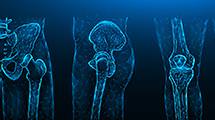 Orthopedics (joints, arthritis)