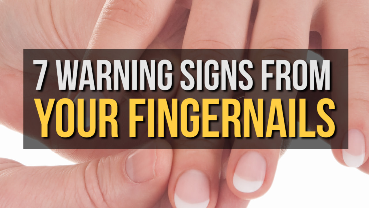 Wow! Your Fingernails Can Tell You a Lot About Your Health
