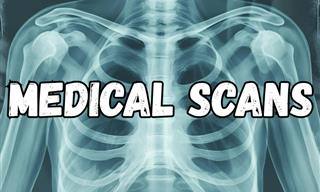 What Do You Know About <b>Medical</b> Scans?