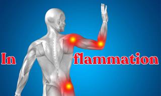 What Do You Know About Inflammation?